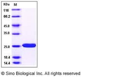 Sino Biological Recombinant Human SOD2/Mn-SOD Protein, Quantity: Each of