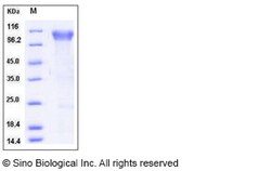 Sino Biological Human BLNK / Ly-57 / SLP-65 Protein (His Tag) 50ug, Quantity: