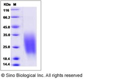 Sino Biological Recombinant Human CREB3L1 Protein (aa 396-519, His Tag),