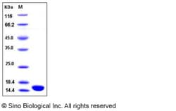 Sino Biological Human ISG15 / G1P2 Protein 1mg, Quantity: Each of 1