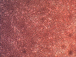 Cell Systems Corporation&nbsp;Primary Human Glomerular Mesangial Cells (ACBRI 127 V)