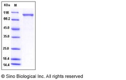 Sino Biological Human USP5 / ISOT Protein (His Tag) 100ug, Quantity: Each