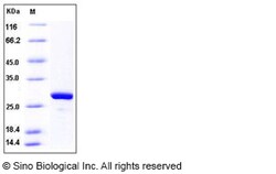 Sino Biological Recombinant Human MAD2L1 Protein (His Tag), Quantity: Each