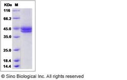 Sino Biological Recombinant Human Factor H-related 1/CFHR1 Protein (His