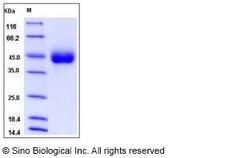 Sino Biological Human KIR2DL3 / CD158B2 / NKAT-2 Protein (His Tag) 100ug,