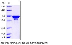 Sino Biological Recombinant Human SerpinB6 Protein (His Tag), Quantity: