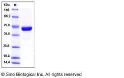 Sino Biological Recombinant Human SerpinB9 Protein (His Tag), Quantity: