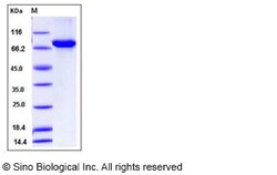 Sino Biological Recombinant Human ALDH4A1 Protein (His & GST Tag), Quantity: