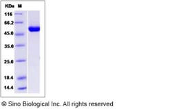 Sino Biological Recombinant Human ALDH4A1 Protein, Quantity: Each of 1