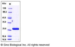 Sino Biological Recombinant Human RAIDD Protein (His Tag), Quantity: Each