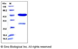 Sino Biological Recombinant Human UNG Protein (GST Tag), Quantity: Each