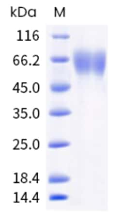 Sino Biological Human TXNDC15 Protein 1MG (Sino Biological), Quantity: