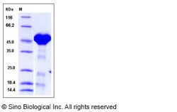 Sino Biological Recombinant Human PPM1A Protein (His Tag), Quantity: Each