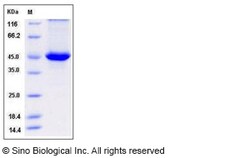 Sino Biological Recombinant Human SERPINB4 Protein (His Tag), Quantity: