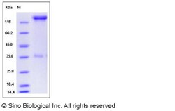 Sino Biological Recombinant Human P-Selectin/CD62P Protein (hFc Tag), Quantity: