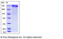 Sino Biological Recombinant Human P-Selectin/CD62P Protein (ECD, His Tag),