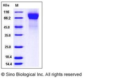 Sino Biological Human RSV (B1) glycoprotein G / RSV-G Protein (His Tag)