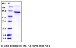 Sino Biological Recombinant Human TRF-1 Protein (His Tag), Quantity: Each
