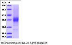 Sino Biological Human KIR2DL4 / CD158D Protein 100ug, Quantity: Each of
