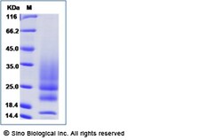 Sino Biological Recombinant Human IL-22 Protein (His Tag), Quantity: Each
