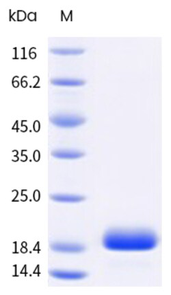 Sino Biological&nbsp;Recombinant Human IL-20 Protein, Biotinylated 100
