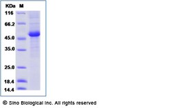 Sino Biological Recombinant Human IL-23 P19/IL23A Protein (mFc Tag), Quantity: