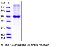 Sino Biological Human PON3 / Paraoxonase 3 Protein (50 Ser/Asn, His Tag)