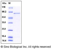 Sino Biological Recombinant Human GOLPH2/GOLM1 Protein (His Tag), Quantity:
