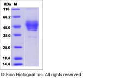 Sino Biological Recombinant Human TSPAN1 Protein (mFc Tag), Quantity: Each