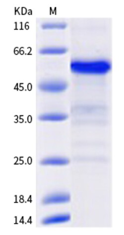 Sino Biological Human RSPO2 Protein 1MG (Sino Biological), Quantity: Each