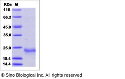 Sino Biological Recombinant Human IL-19 Protein (His Tag), Quantity: Each