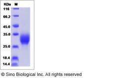 Sino Biological Human IL19 / Interleukin-19 Protein (His Tag) 50ug, Quantity: