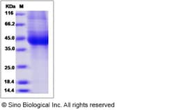 Sino Biological Recombinant Human IL-17RB Protein (His Tag), HPLC-verified