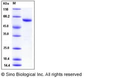 Sino Biological Recombinant Human Thioredoxin reductase 1/TRXR1 Protein