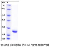 Sino Biological Recombinant Human SUMO1 Protein (His Tag), Quantity: Each