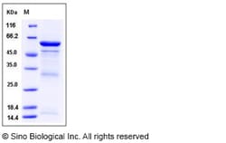 Sino Biological Recombinant Human TLE3 Protein (aa 484-772, GST Tag), Quantity:
