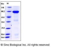 Sino Biological Recombinant Human IGFBP7 Protein (hFc Tag), HPLC-verified
