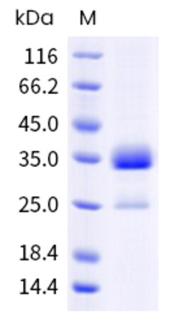 Sino Biological Human IGFBP7 Protein 1MG (Sino Biological), Quantity: Each