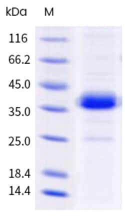 Sino Biological Human IGFBP7 Protein 1MG (Sino Biological), Quantity: Each