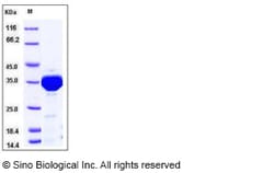 Sino Biological Aequorea victoria GFP Protein (His Tag) 100ug, Quantity: