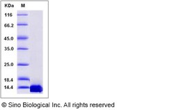 Sino Biological Human TFAP2C / AP2-GAMMA Protein (His Tag) 100ug, Quantity: