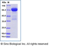 Sino Biological Human MSLN / Mesothelin Protein (Fc Tag), Biotinylated