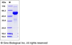 Sino Biological Recombinant Human Mesothelin Protein (hFc Tag), Quantity: