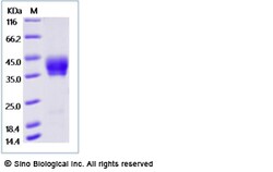 Sino Biological Recombinant Human Mesothelin Protein (His Tag), HPLC-verified