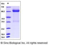 Sino Biological Human KIR2DL1 / CD158a Protein (Fc Tag) 50ug, Quantity: