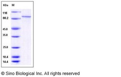 Sino Biological Recombinant Human CaMKI gamma/CAMK1G Protein (His & GST