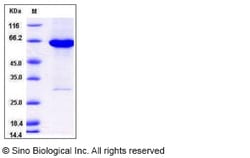 Sino Biological Human ADK Protein (His & GST Tag) 50ug, Quantity: Each