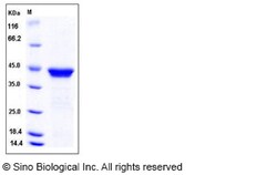 Sino Biological Recombinant Human p53R2 Protein (His Tag), Quantity: Each