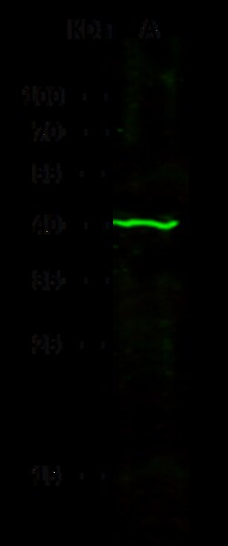 Sino Biological RRM2B / P53R2 Antibody, Mouse MAb 100µL, Quantity: Each