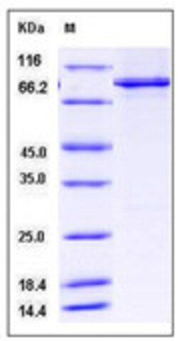 Sino Biological Recombinant Human PTP alpha/PTPRA Protein (aa 174-793,
